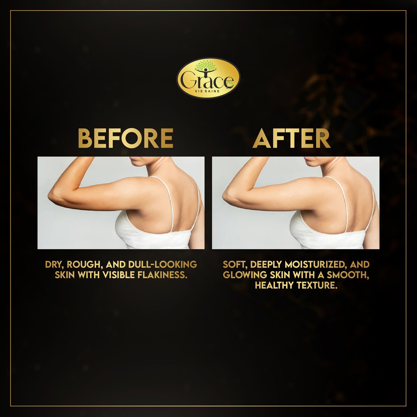 Skin before and after using Donkey Milk Lotion