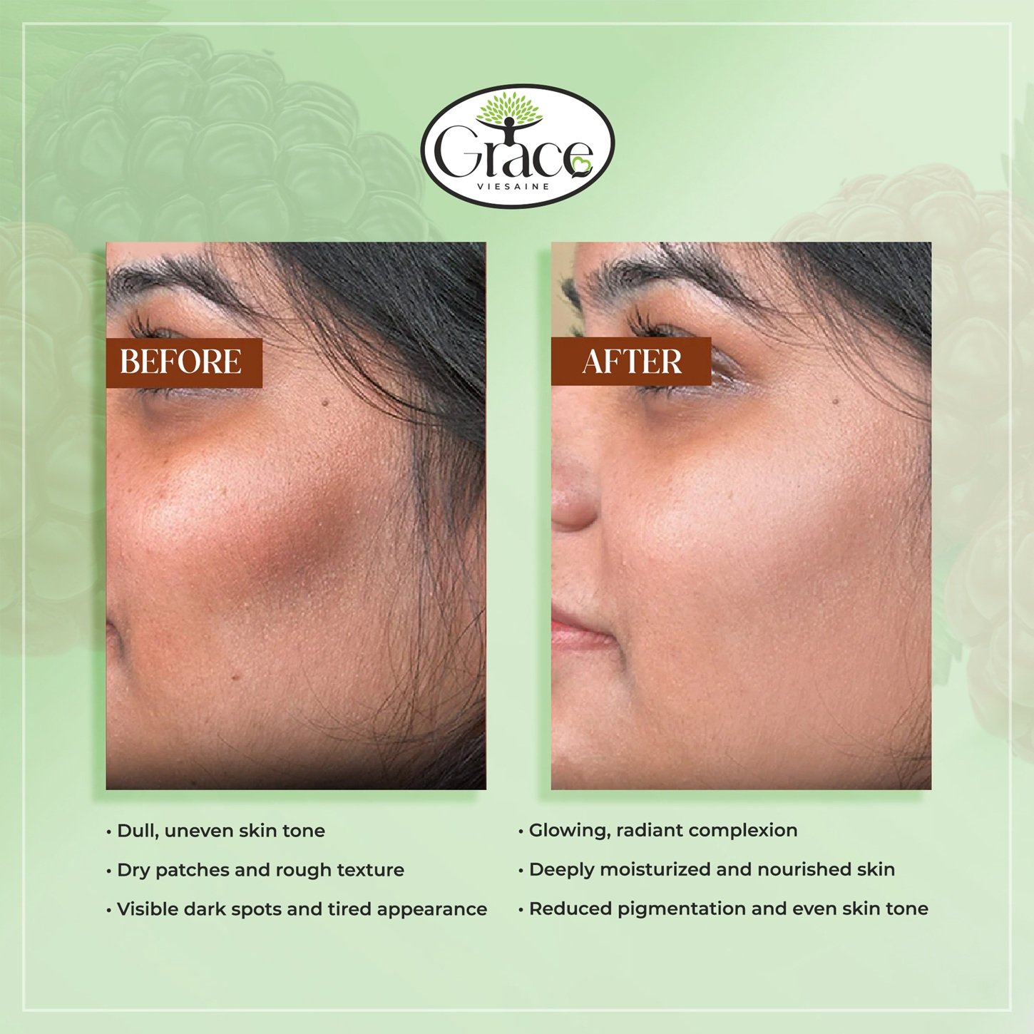 Skin transformation using Evergreen Lush Dream Cream