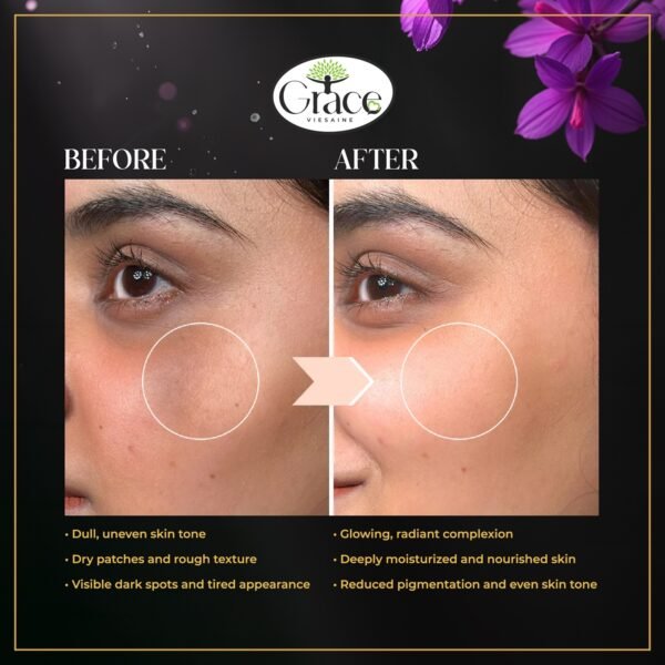 Before and after using Kumkumadi Moisturizer